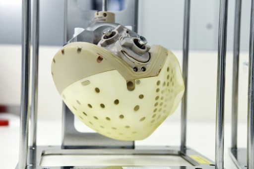 Carmat a vendu pour la première fois un coeur artificiel, en Italie