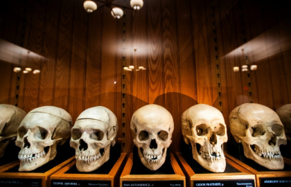 La collection de crânes d'un anatomiste autrichien au Mütter Museum de Philadelphie, le 20 août 2025 en Pennsylvanie - Matthew Hatcher (AFP)